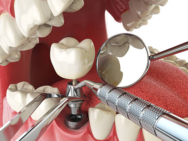 Best Emergency Dentist for Special Needs Patients in Lithia Springs, GA