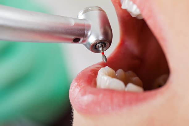 Best Orthodontic Emergency Dentist in Lithia Springs, GA